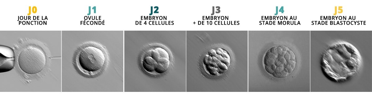 Transfert Embryon Les techniques - Laboratoire Diaconat